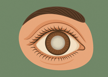 Chirurgia della Cataratta